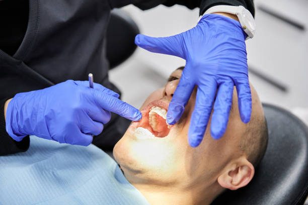 Best Emergency Treatment for Dental Infections or Abscesses in Vernon Center, NJ